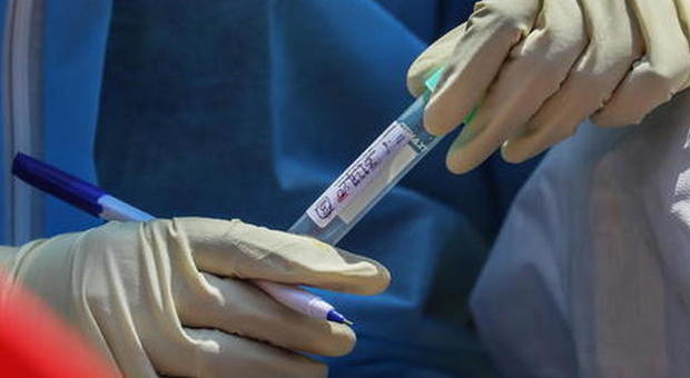 Coronavirus in Italia, 30 morti e 259 casi positivi in più: 156 in Lombardia, 46 in Emilia Romagna. Tornano a salire le terapie intensive