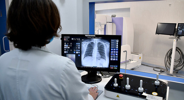 Sanità, nel Lazio parte la radiologia a domicilio: a regime entro fine anno