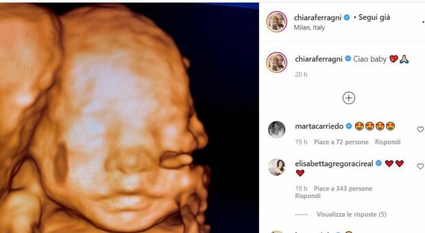 Chiara Ferragni, ecografia 3D su Instagram ma il nome della bambina ancora non c'è