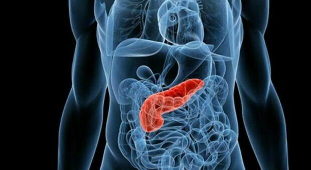 Tumore al pancreas metastatico, il nuovo farmaco Nal-IRI aumenta le possibilità di sopravvivenza