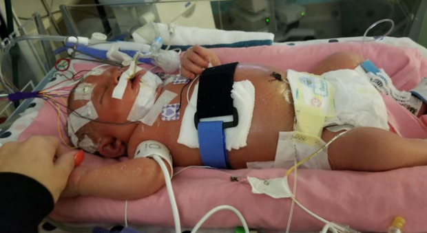 Meningite, neonata muore: Mariana, 18 giorni, ha contratto il virus dopo il bacio di un amico di famiglia