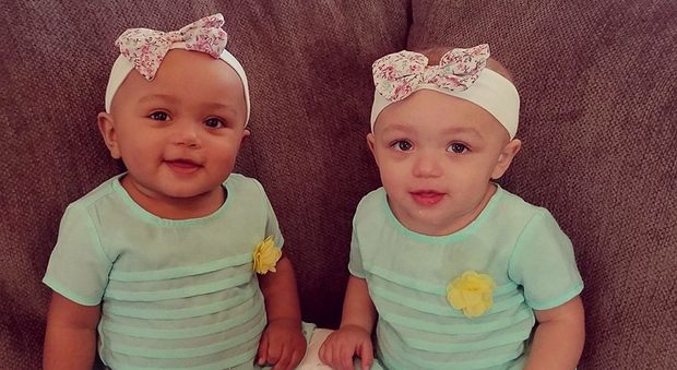 Una è bianca, l'altra è nera: come è possibile? Le gemelline festeggiano il primo compleanno