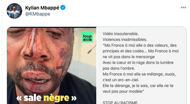 Quattro poliziotti picchiano un uomo di colore: incastrati da un video choc. Orrore e bufera in Francia: «Macron furioso»