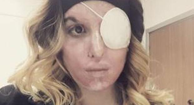 Gessica Notaro, il primo selfie su Instagram: "Pagherà chi ti ha fatto del male..." -Guarda