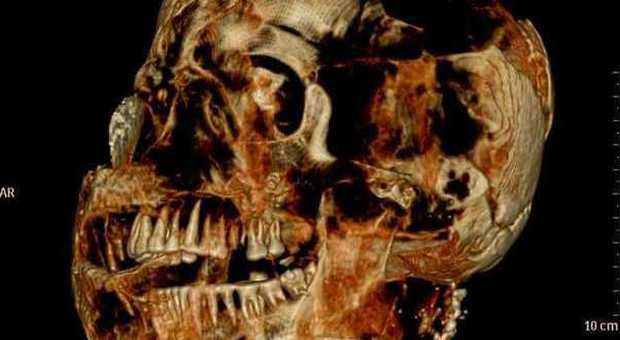 Pompei, Tac su trenta calchi delle vittime dell'eruzione: i denti sono perfetti