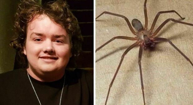 Studente muore a 19 anni dopo il morso di un ragno sulla schiena: la ferita grande come una moneta