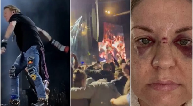 Guns N' Roses, Axl lancia microfono tra il pubblico: donna colpita e ferita al volto.