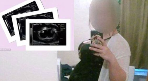 Ragazzina di 16 anni finge di essere incinta: ​"Aspetto tre gemelli". Ecco perché l'ha fatto