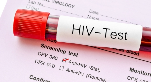 Aids, cresce la diffusione di ceppi di Hiv resistenti ai farmaci