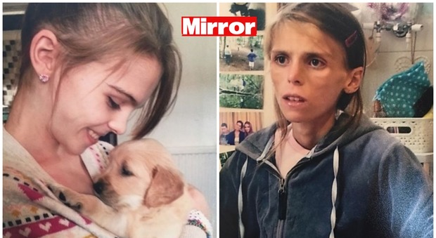 "L'anoressia ha vinto". Pippa scrive una lettera d'addio al cane si getta sotto il treno e muore a 15 anni