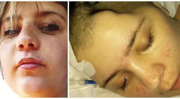 Chiara, 11 mesi in coma per le botte dell'ex fidanzato. Il padre pubblica la foto su Fb | Guarda