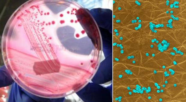 Superbatteri resistenti agli antibiotici, scoperta la sostanza in grado di ucciderli