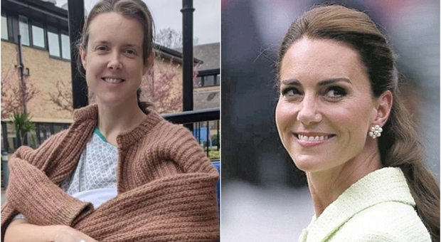 Cancro di Kate, una 38enne londinese racconta di aver avuto un tumore simile: «Provo molta empatia per la principessa»