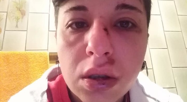 Giulia denuncia aggressione su Fb: «Picchiata perché lesbica, mi hanno detto che devo morire»