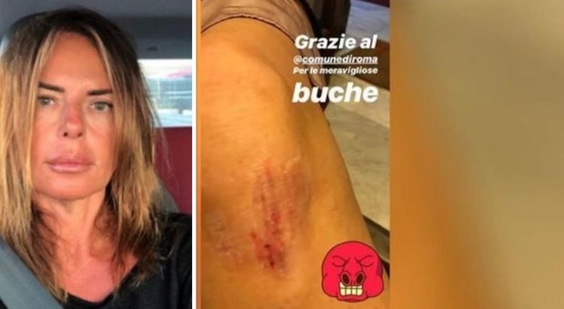 Paola Perego cade in una buca e si sfoga su Instagram: «Grazie Roma»