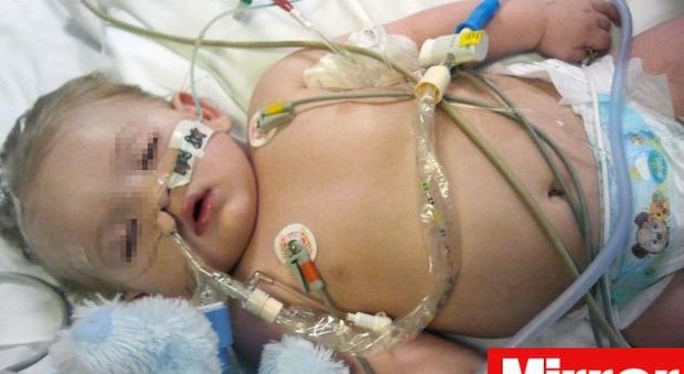 Il figlio muore a 14 mesi per la meningite, la madre pubblica la foto del piccolo morente