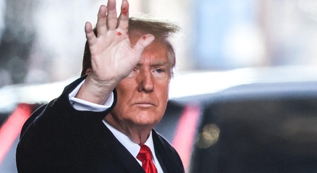 Donald Trump con segni misteriosi sulla mano, quali potrebbero essere le cause?