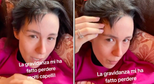 Aurora Ramazzotti, la perdita dei capelli durante la gravidanza: «Pensavo di rimanere pelata»
