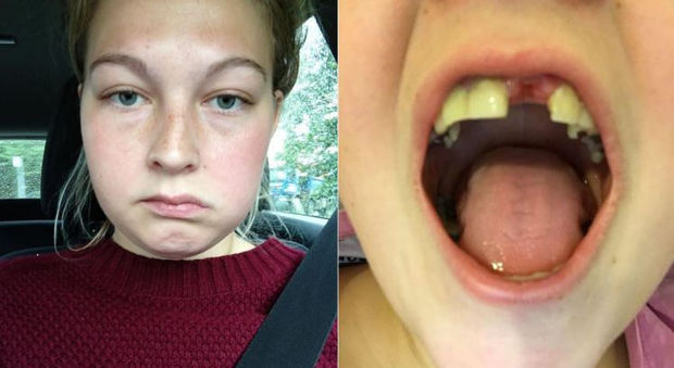 "Aiutatemi, i miei denti si stanno sgretolando senza motivo"