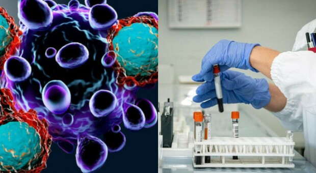 Tumore, nuova terapia: scoperti farmaci che agiscono sulle cellule resistenti alla chemio
