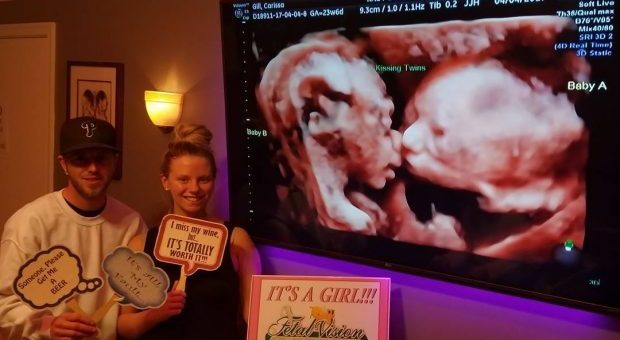 Le gemelline e il bacio nel pancione di mamma: l'ecografia "tenera" fa il giro del web