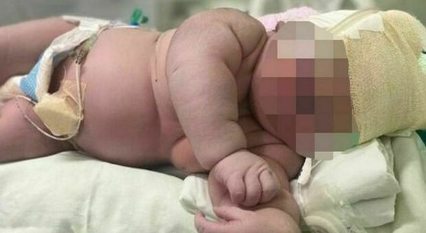 Parto record in Brasile: donna dà alla luce un bimbo "gigante", pesa 7 chili e mezzo ed è alto 60 centimetri