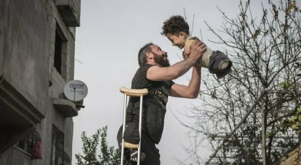 Bimbo e papà mutilati dalla guerra, dalla Siria in Italia per guarire