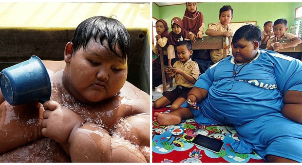 Il bambino più grasso del mondo ha 10 anni e pesa 192 chili