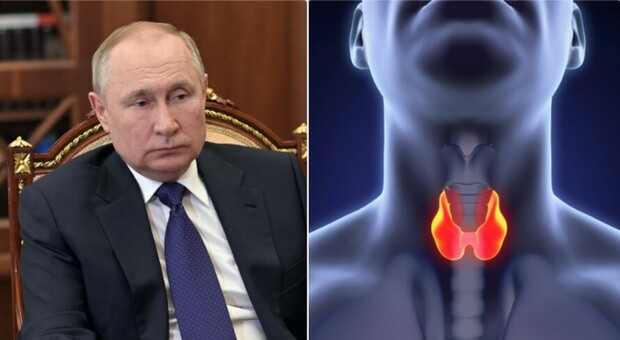 Tumore alla tiroide, sintomi e cure: cos'è la malattia attribuita a Putin