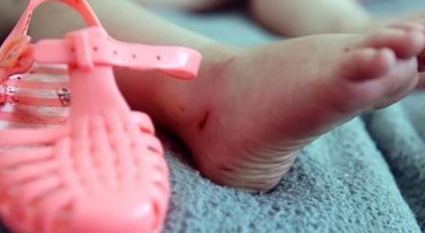 Sandaletti di plastica per la bimba di due anni: dopo solo 30 minuti la reazione choc