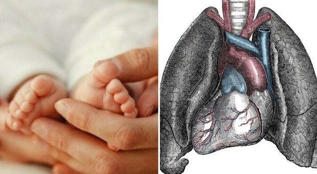 Neonata nasce con cuore e stomaco a destra, la soddisfazione dei medici: «La piccola sta bene. Parto straordinario, malformazione rarissima»