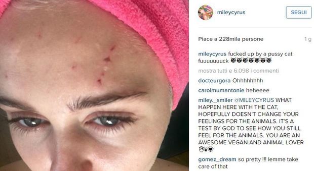 Miley Cyrus ferita dal gatto (Instagram)