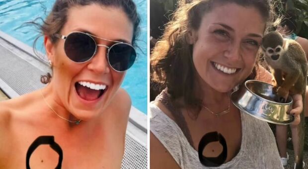 https://statics.cedscdn.it/photos/MED/2025/06/03/8875643_03122851_neo_diagnosi_cancro_melanoma_abbronzatura_protezione_solare_cicatrici_oggi_3_6_2025.jpg