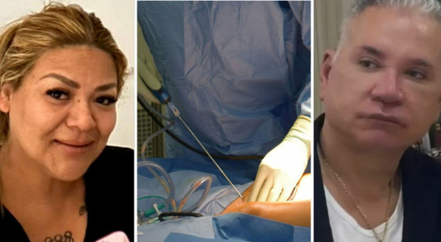 https://statics.cedscdn.it/photos/MED/2025/06/11/8892110_11185918_donna_morta_dopo_liposuzione_racconto_fidanzato_cosa_e_successo_ana_sergia_alcivar_chenche_primavalle_roma_oggi_11_6_2025.jpg