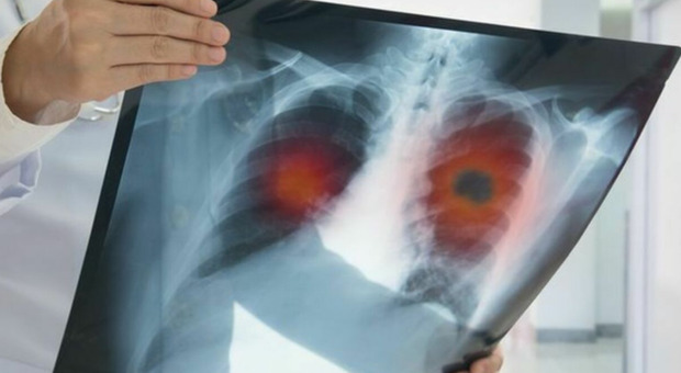 https://statics.cedscdn.it/photos/MED/2025/07/02/8933247_02143623_lo_smog_causa_il_tumore_ai_polmoni_anche_dei_non_fumatori_lo_studio_danneggia_il_dna_come_le_siga.jpg