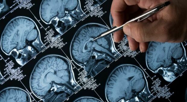 https://statics.cedscdn.it/photos/MED/2025/07/21/8969035_21120534_alzheimer_parkinson.jpg