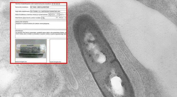 https://statics.cedscdn.it/photos/MED/2025/08/14/9013202_14181009_listeria.jpg