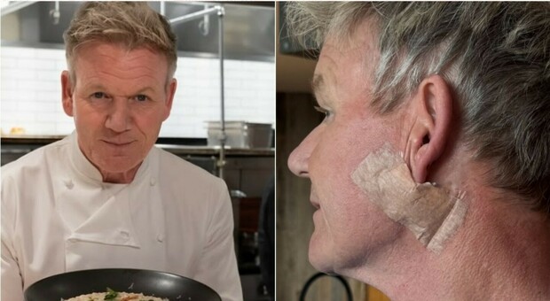 https://statics.cedscdn.it/photos/MED/2025/08/30/9039111_30130248_gordon_ramsey_tumore.jpg