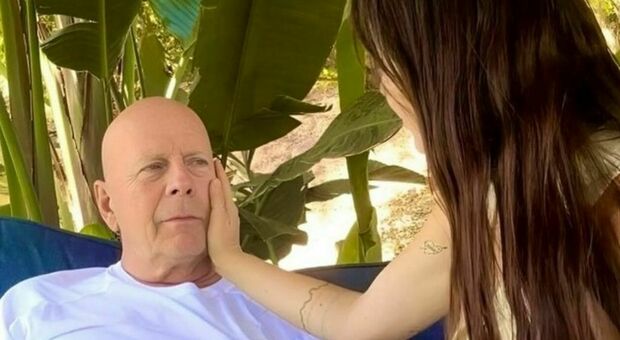 https://statics.cedscdn.it/photos/MED/2025/09/01/9042669_01191514_bruce_willis_tradito_cervello_come_vive_assistito_specialisti_demenza_frontotemporale_cosa_e_sintomi_cure.jpg