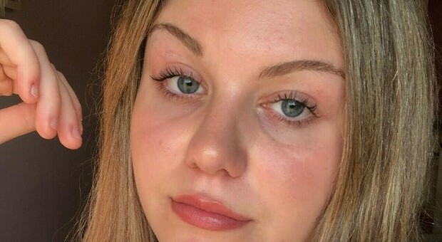 Eleonora Chieregato muore a 17 anni per una malattia autoimmune: i primi sintomi ad aprile, il malore in treno e il decesso