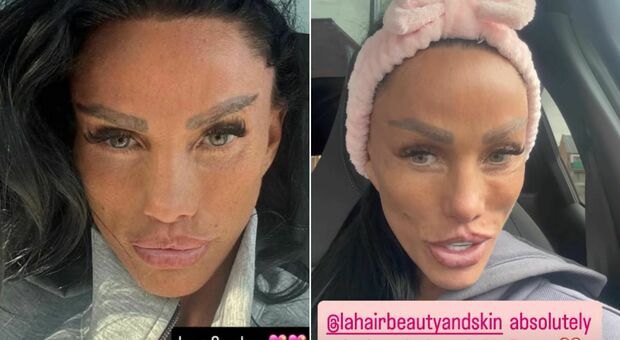 https://statics.cedscdn.it/photos/MED/2025/10/26/9150688_26155035_katie_price_botox.jpg