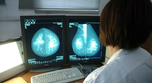 Mammografie gratuite, arriva l'iniziativa a sostegno della salute femminile: ecco come prenotare Mammografie gratuite, arriva l'iniziativa a sostegno della salute femminile: ecco come prenotare