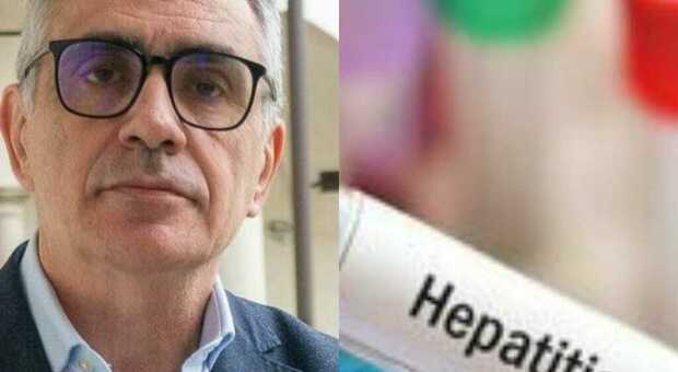  Epatite A in Campania, Pregliasco: «In Italia casi in aumento, a Napoli focolaio non epidemia» 