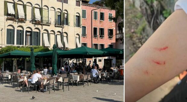 Borseggiatrici, ristoratrice picchiata perch&eacute; sventa lo scippo: &laquo;Io e i miei colleghi veniamo aggrediti ogni giorno&raquo;