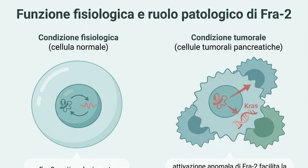 https://statics.cedscdn.it/photos/MED/2026/05/04/9510826_04145527_tumore_pancreas.jpg