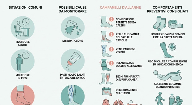 I calzini lasciano il segno? Potrebbe essere sintomo di problemi al cuore: ecco quando preoccuparsi