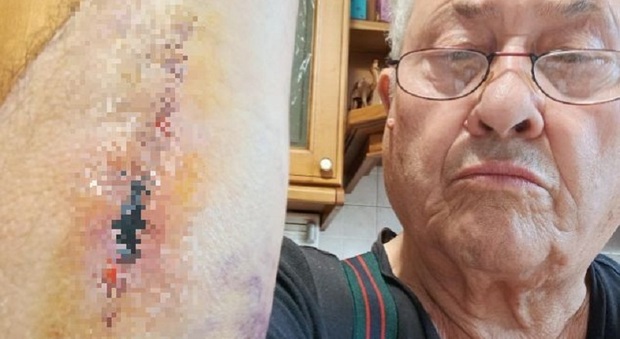 Ottantenne cade sulla rampa dei Servizi sociali e si ferisce: &laquo;Quel gradino &egrave; una trappola, nessuno l&rsquo;ha segnalato&raquo;