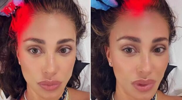 Belen: «Ho perso i capelli per colpa dei farmaci». Iniziato il trattamento: quanto costa e come funziona