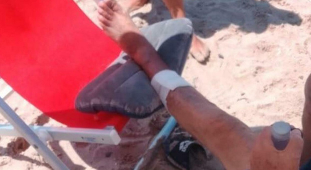 https://statics.cedscdn.it/photos/MED/2026/07/24/9670141_24110947_pesci_morsi_bagnanti.jpg