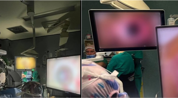 https://statics.cedscdn.it/photos/MED/2026/07/26/9673741_26112621_trapianto_retina_occhio_occhio_recupera_vista_torino.jpg